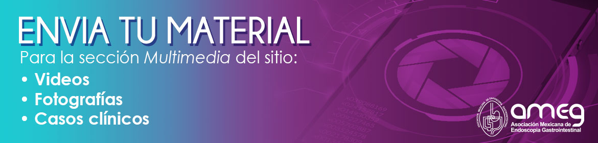 Invitacion material