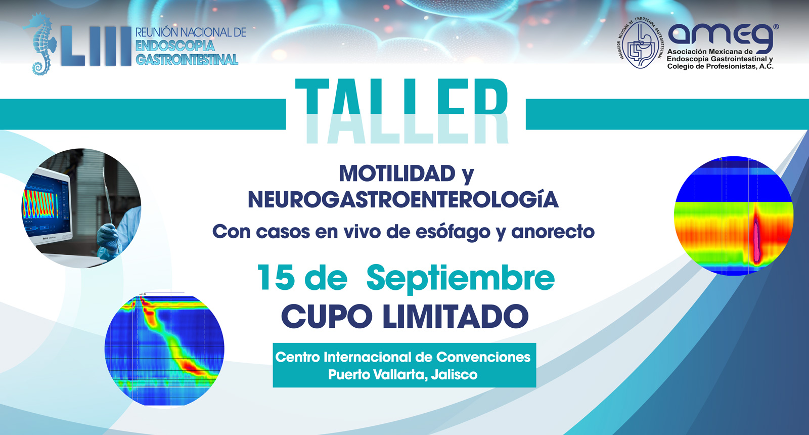 Taller de Motilidad y Neurogastroenterología
