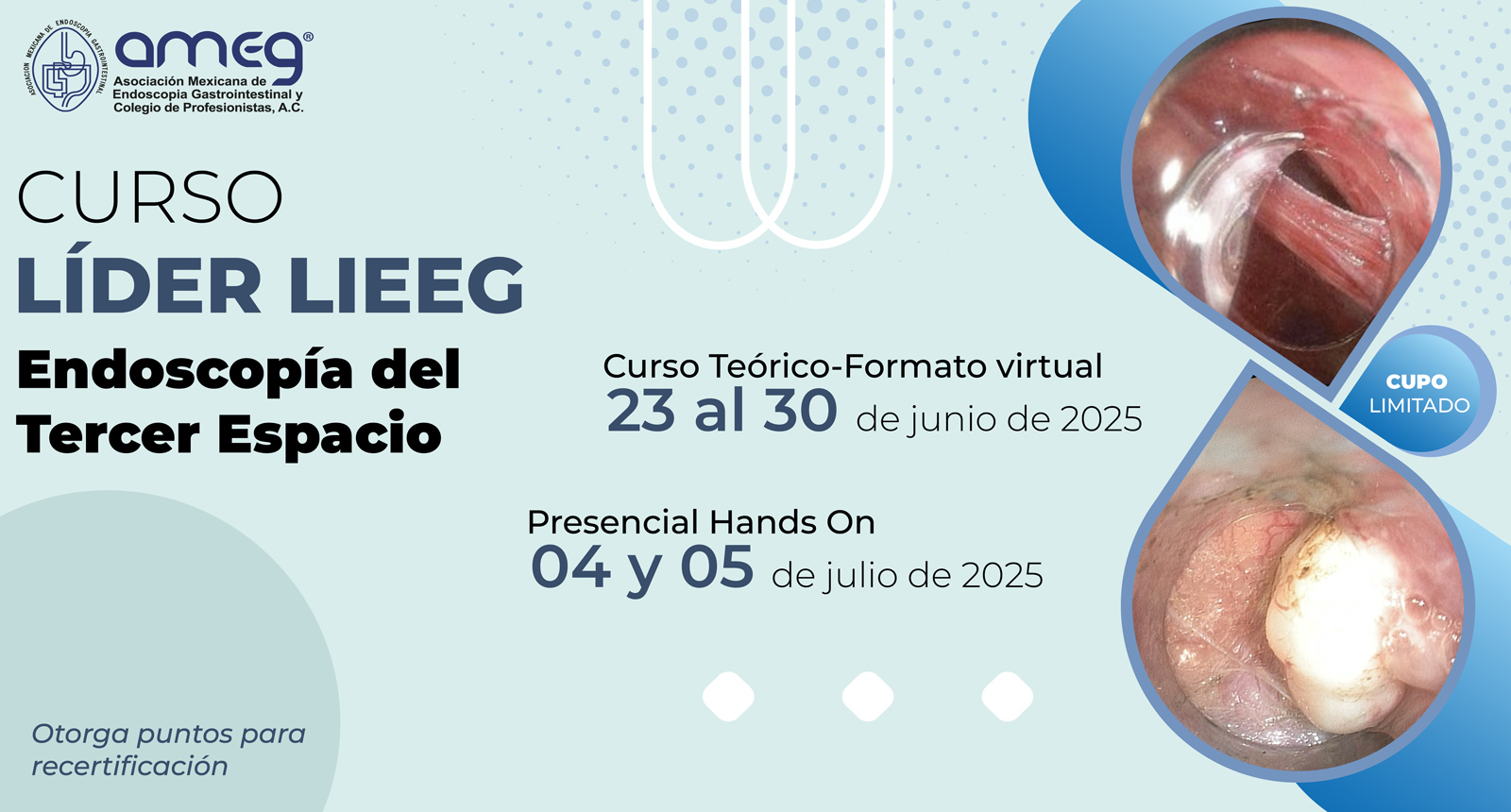 Curso LIEEG: Endoscopia del Tercer Espacio