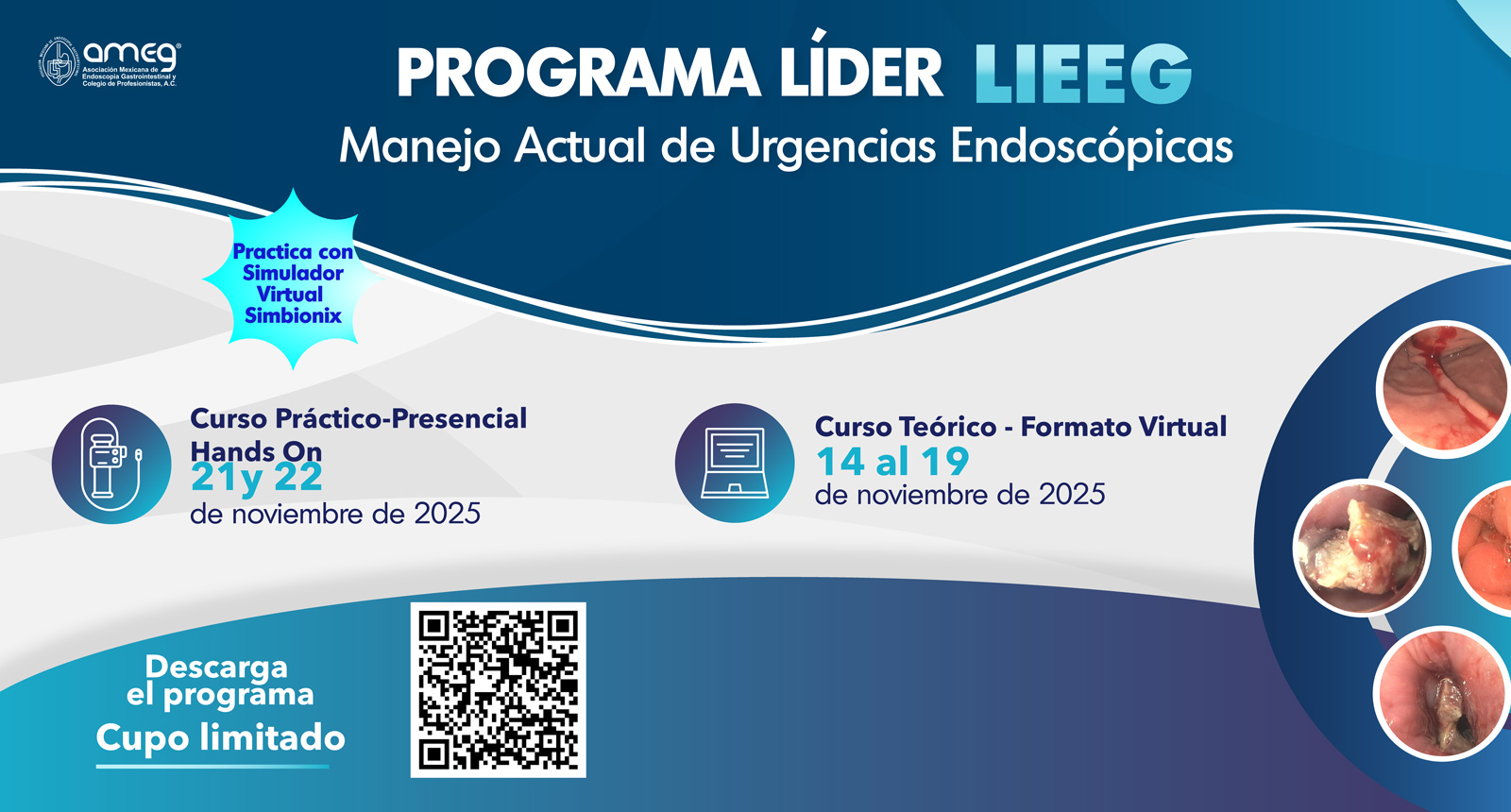 Curso LIEEEG Urgencias Endoscopicas
